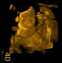 A Window To Your Womb - Canberra, Queanbeyan and Yass
